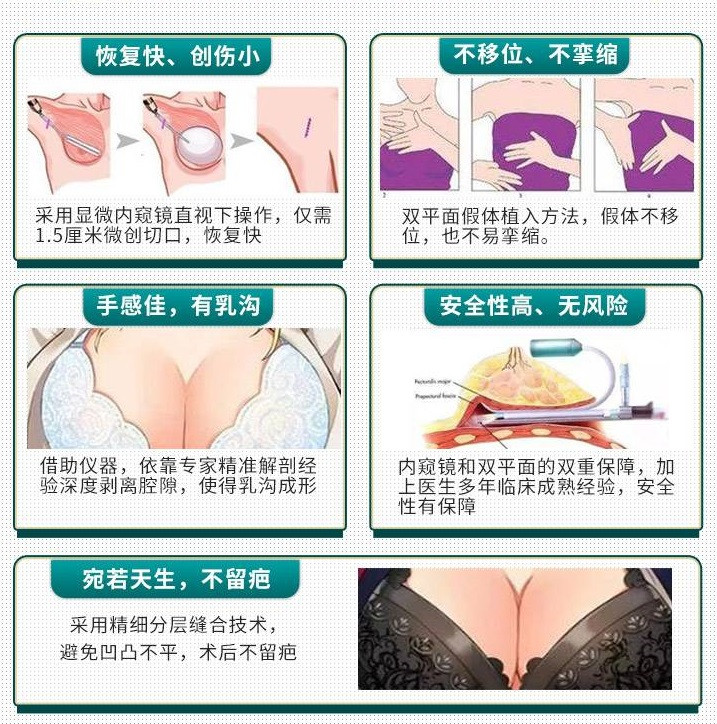 祁门假体隆胸整形哪家医院好-假体隆胸手术价格效果如何