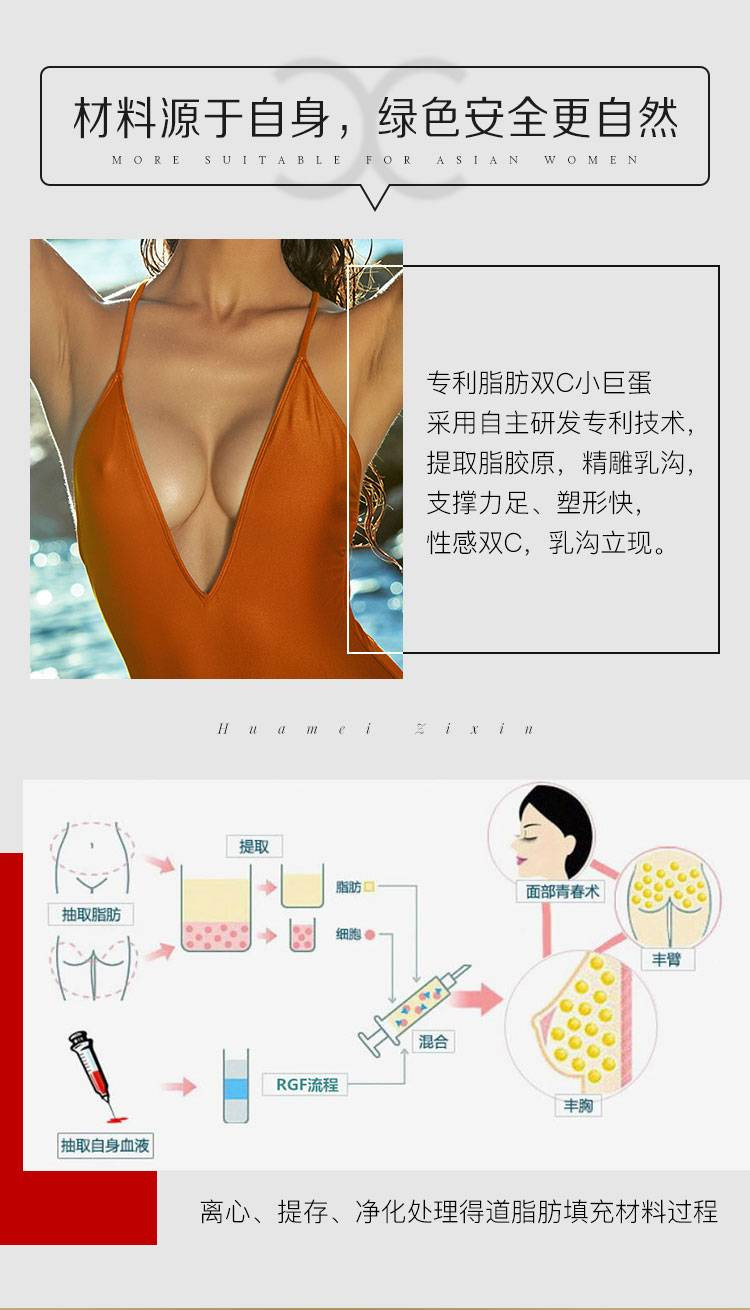 祁门自体脂肪隆胸哪家整形医院哪家好-自体脂肪隆胸价格效果如何