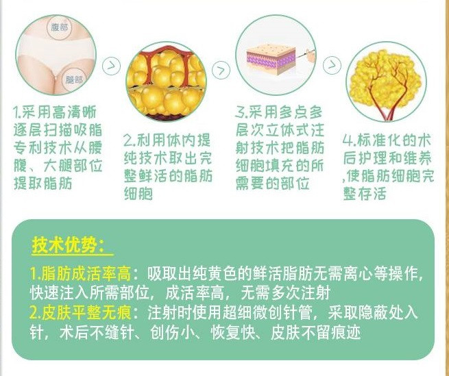 祁门自体脂肪隆鼻整形哪家医院好-自体脂肪隆鼻价格多少效果如何