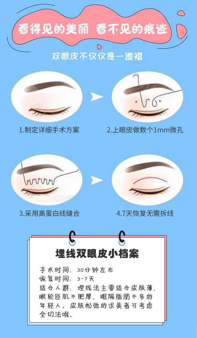 祁门埋线双眼皮整形哪家医院好-埋线双眼皮价格多少效果如何
